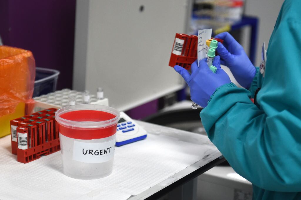 Laboratorio en Wellington realiza exámenes del Covid-19