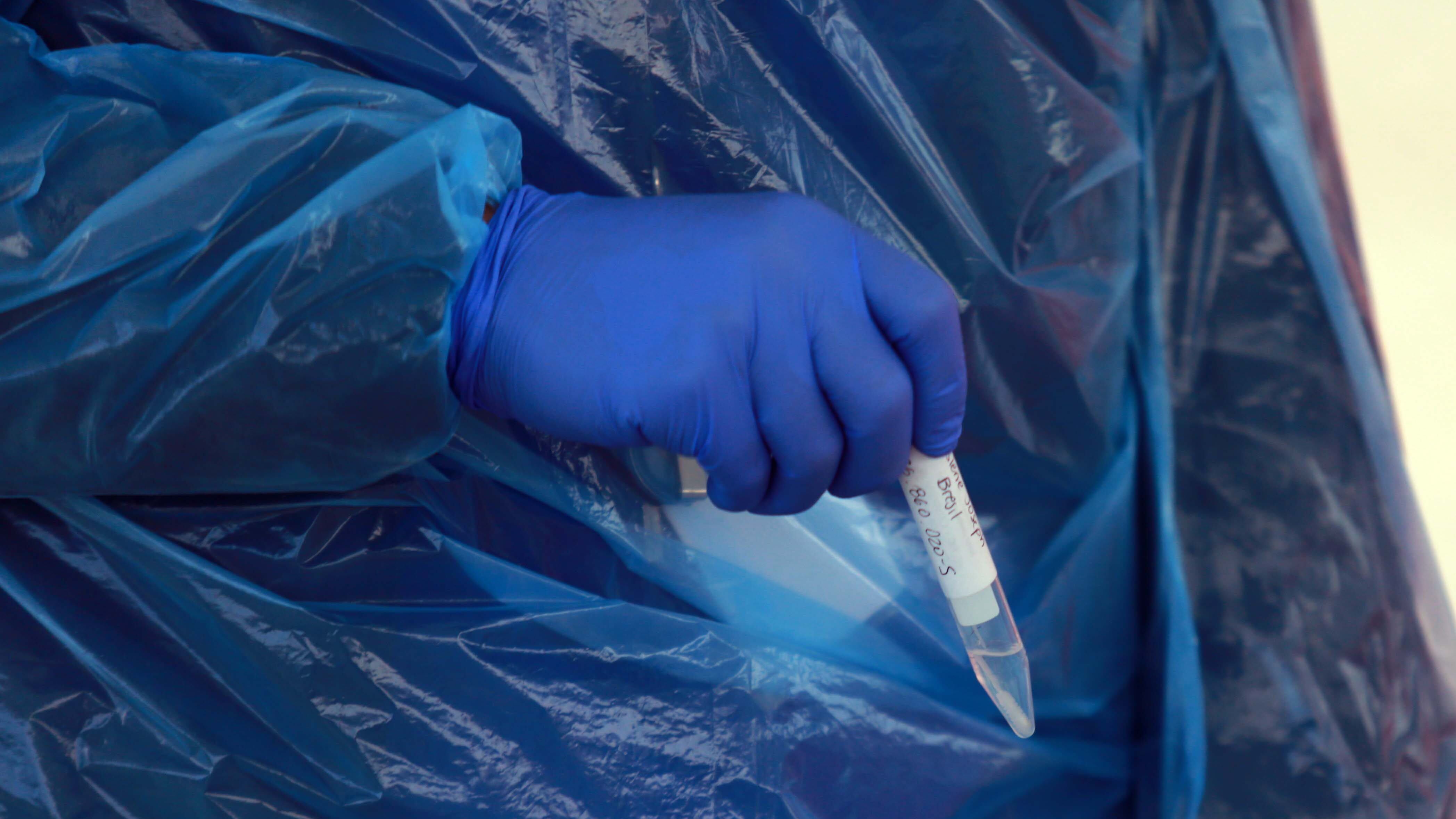 10 de Julio de 2020/SANTIAGO
Muestra de examen, durante que la municipalidad de Puente Alto realiza test PCR para la detección del COVID 19 a trabajadores de ferias libres en la comuna , donde son aprox. 2.550 personas que trabajan en el rubro de los alimentos.
FOTO: JOSE FRANCISCO ZUÑIGA/AGENCIAUNO