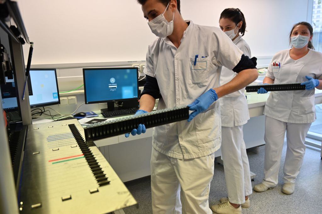 Trabajadores de la salud analizan test del Covid-19 en Francia