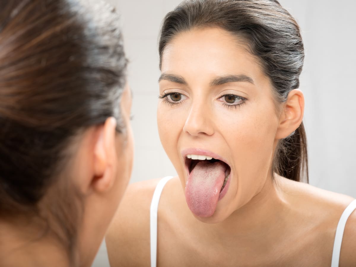 Qué significa tener la lengua blanca, según expertos en salud