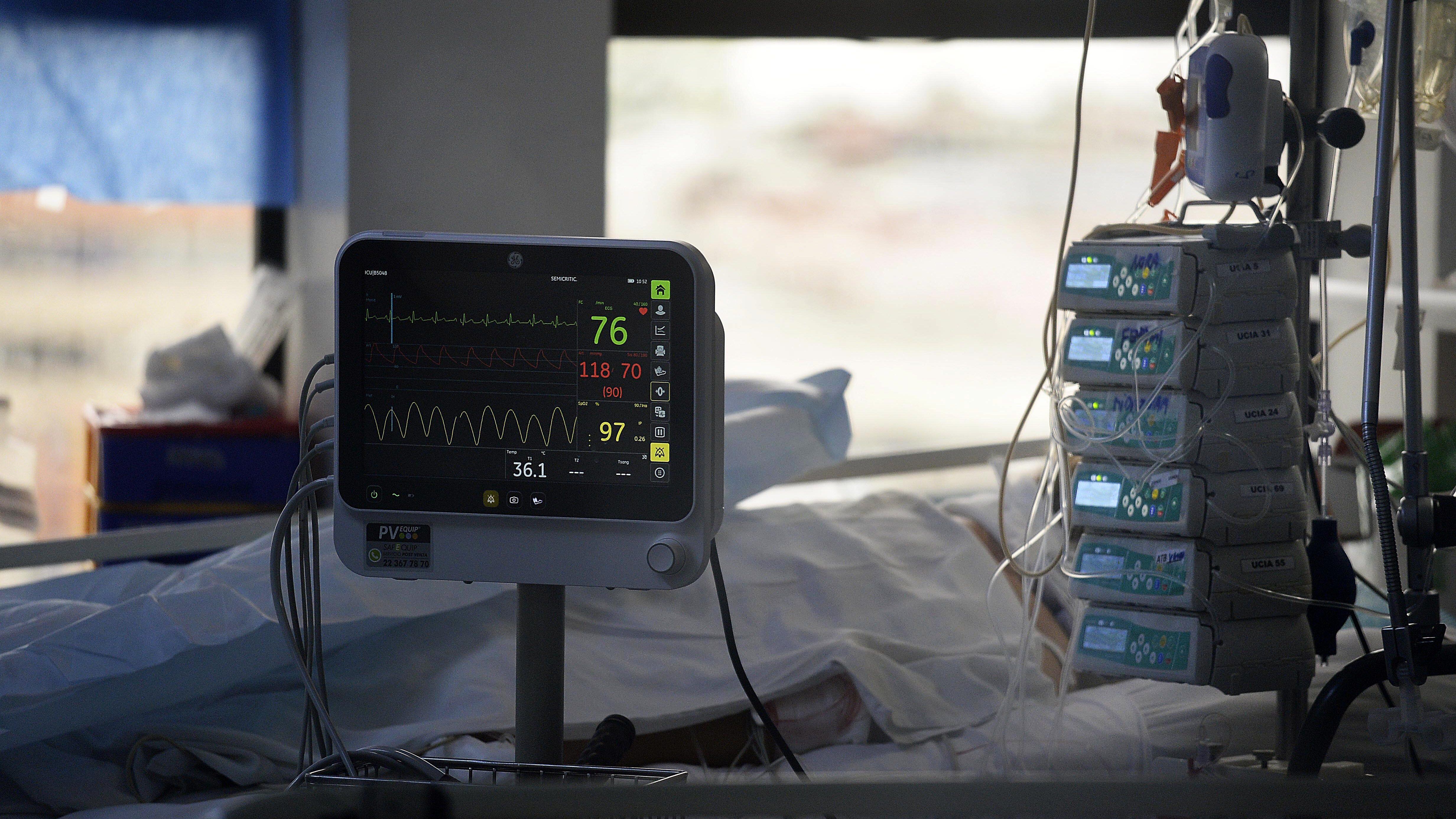22 de JUNIO de 2020/VALPARAISOPaciente en la unidad de cuidados intensivos COVID-19 (UCI) en el hospital Carlos Van Buren a una semana de la cuarentena total por la pandemia coronavirus que vive el país
FOTO: PABLO OVALLE ISASMENDI/AGENCIAUNO