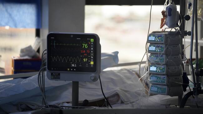 22 de JUNIO de 2020/VALPARAISOPaciente en la unidad de cuidados intensivos COVID-19 (UCI) en el hospital Carlos Van Buren a una semana de la cuarentena total por la pandemia coronavirus que vive el país
FOTO: PABLO OVALLE ISASMENDI/AGENCIAUNO