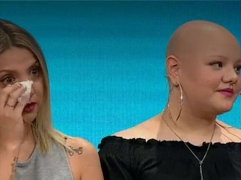 Nicole Pérez contó detalles de la alopecia que sufre su hija