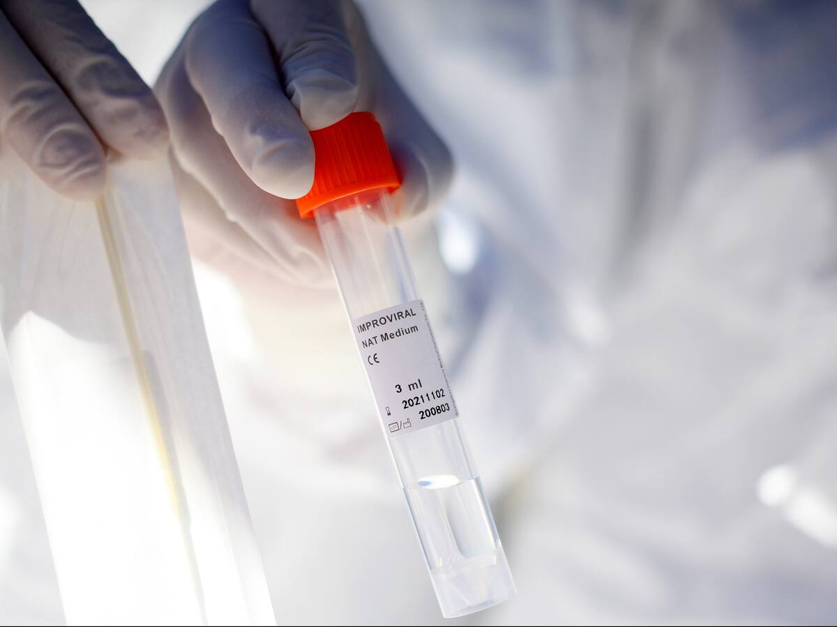 Coronavirus: Ministerio de Salud informó 3.448 nuevos casos en las últimas 24 horas