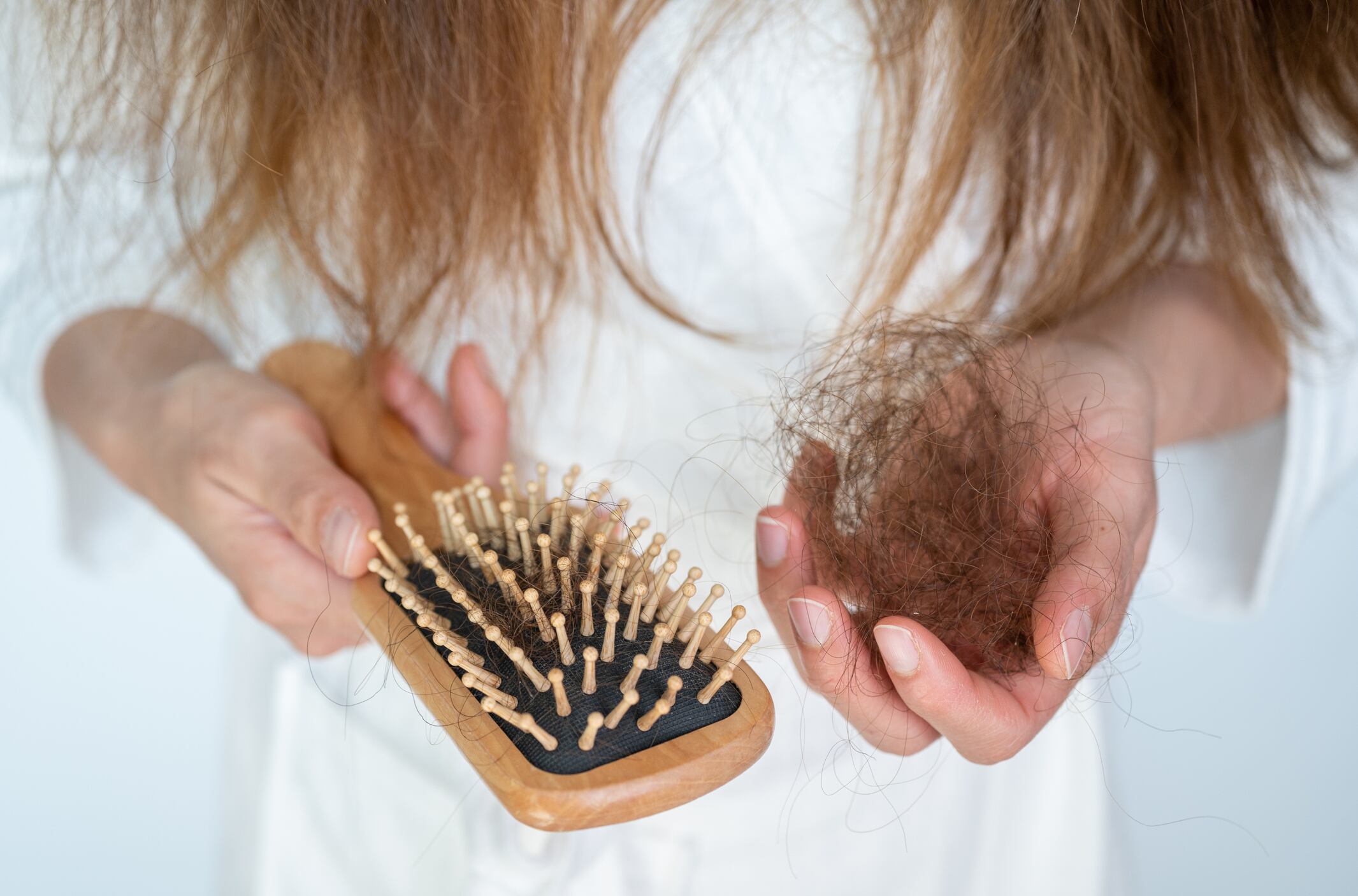 Pérdida de cabello