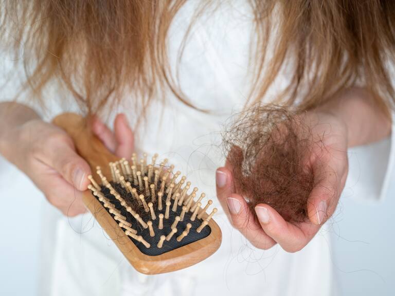 Pérdida de cabello