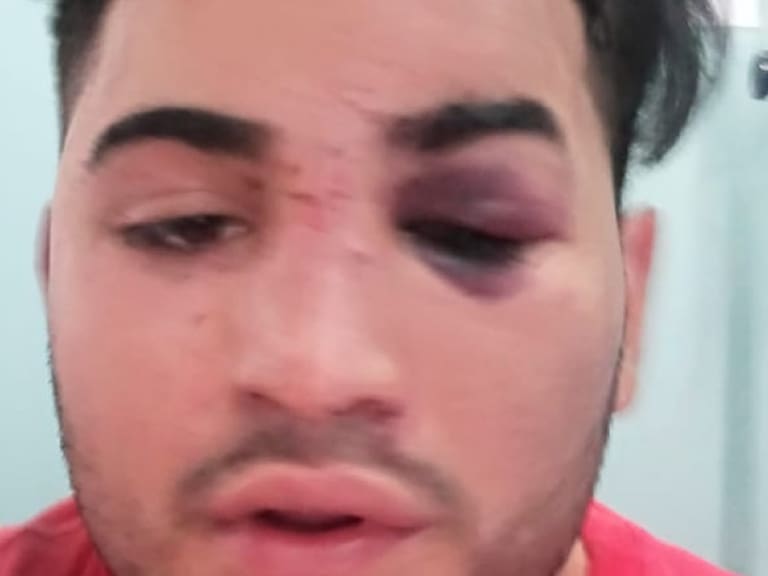 Denunciaron nueva golpiza en contra de otro joven por parte de Carabineros