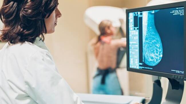 prevención cáncer de mama