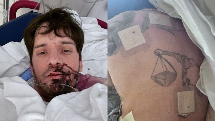 Apuñalado y con un pulmón colapsado: creador de contenido para adultos sufre brutal ataque