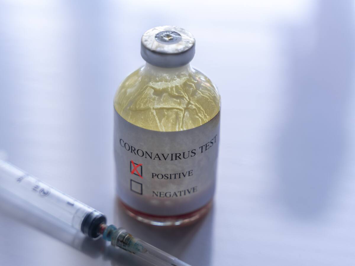 Italia registró la segunda cifra más baja de fallecidos en la última semana a causa del coronavirus