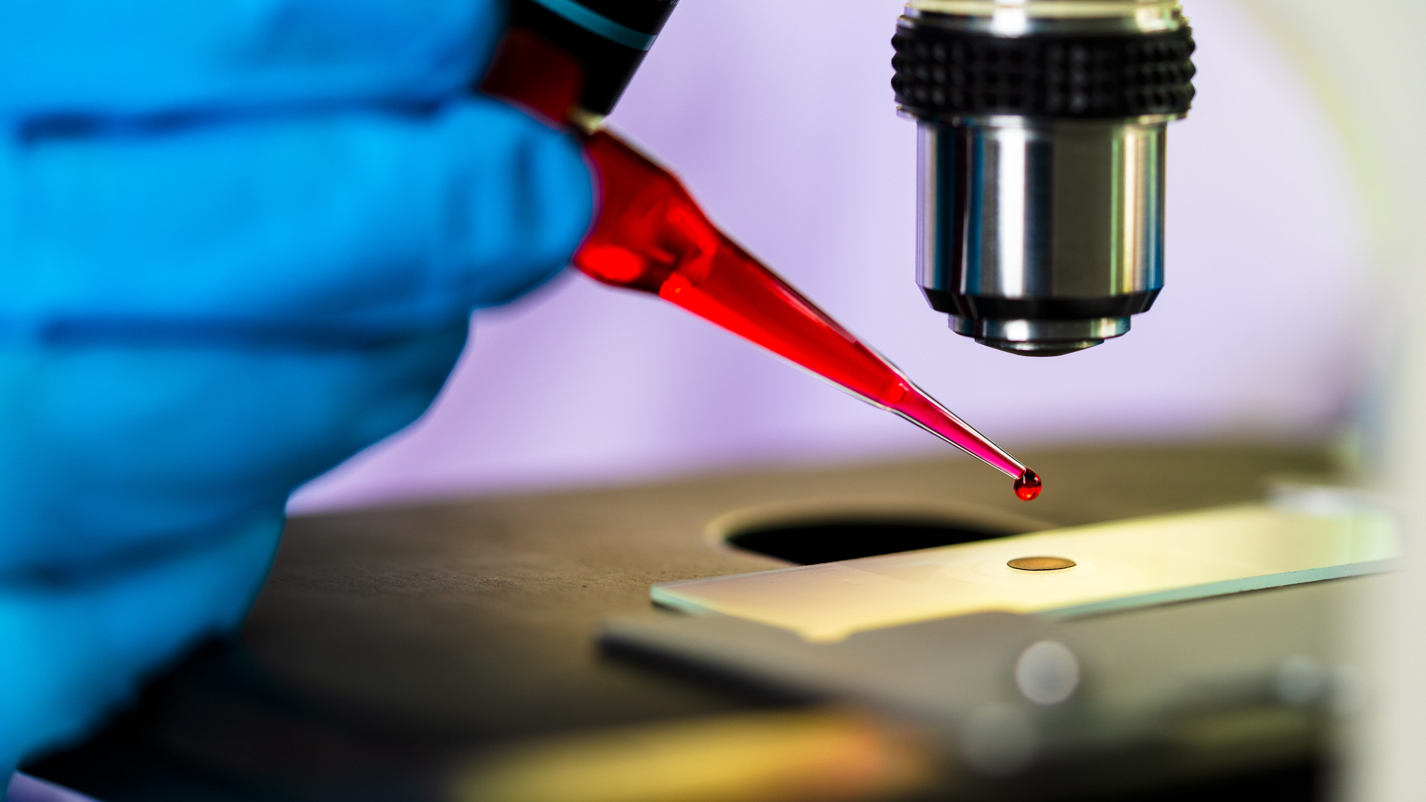 Scientist dropping medical blood to the glass slide for preparation sample in laboratory.