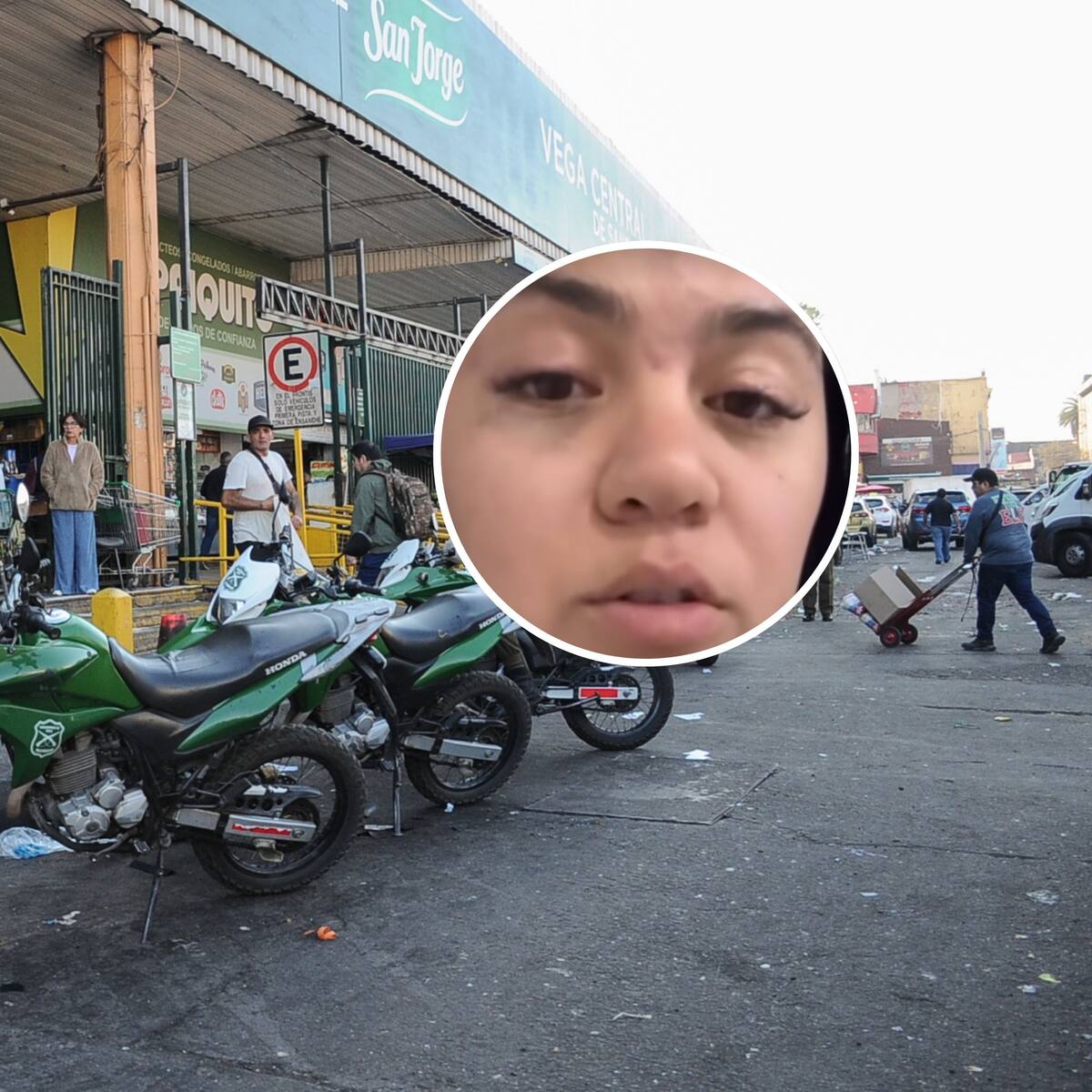 Joven venezolana denuncia brutal golpiza en La Vega Central: vocero del mercado desmiente su versión