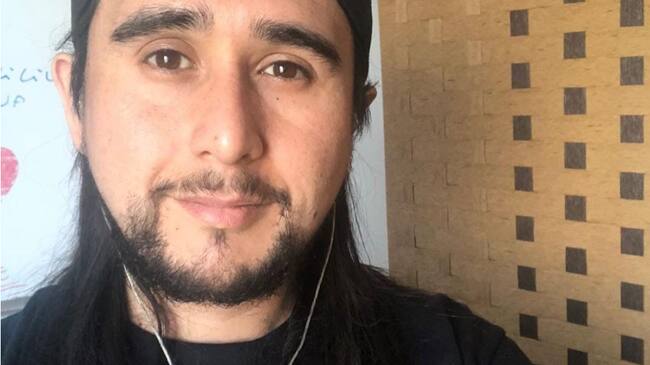 Luego de dos meses: Nico Cid retoma su carrera de cantante tras operación por cáncer