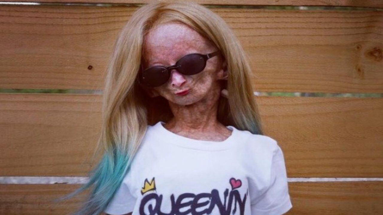 Muere Adalia Rose