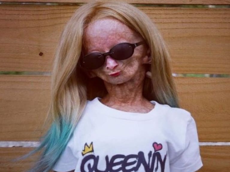 Muere Adalia Rose