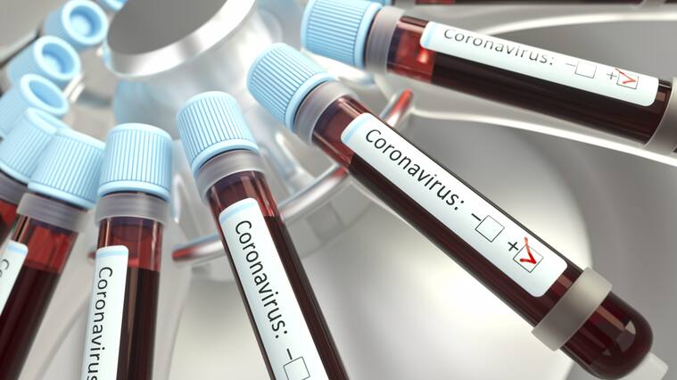 Coronaviruses research, conceptual illustration. Vials of blood in a centrifuge being tested for coronavirus infection.