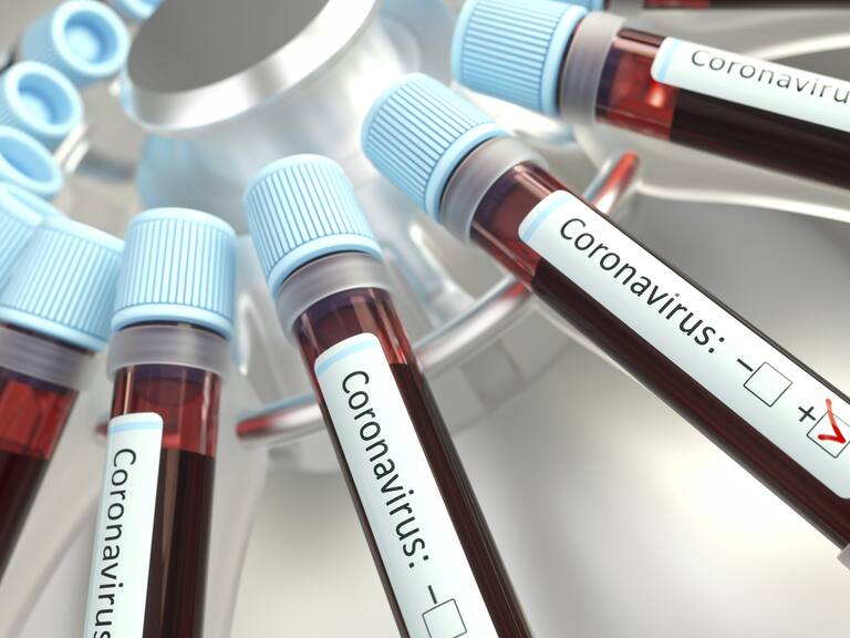 Coronaviruses research, conceptual illustration. Vials of blood in a centrifuge being tested for coronavirus infection.