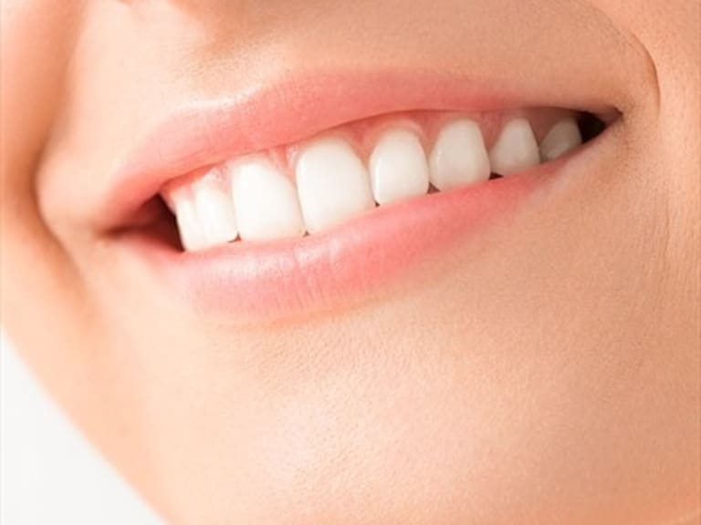 Empresa de cuidado dental publicó anuncio de una boca con muchos dientes y usuarios la criticaron