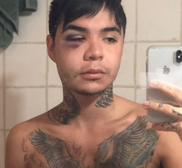 Clínica responde a Leo Méndez Jr. tras ser acusados de realizar mal una cirugía estética