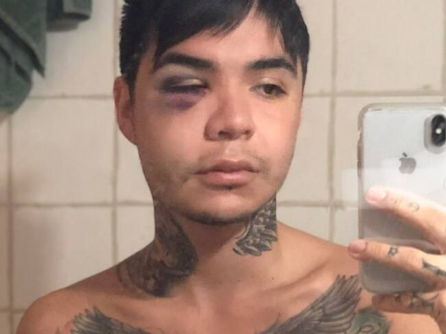 Clínica responde a Leo Méndez Jr. tras ser acusados de realizar mal una cirugía estética