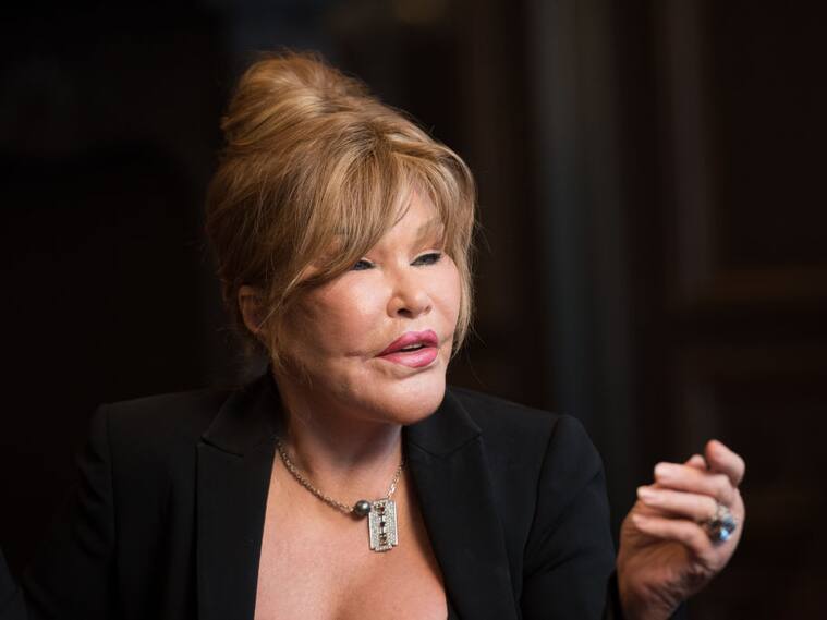 Muere Jocelyn Wildenstein, popularmente conocida como ‘Catwoman’, a los 84 años