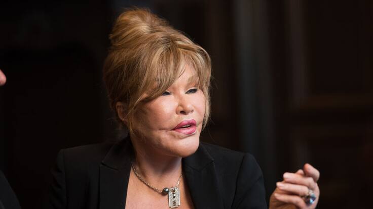 Muere Jocelyn Wildenstein, popularmente conocida como la “mujer gato”, a los 84 años
