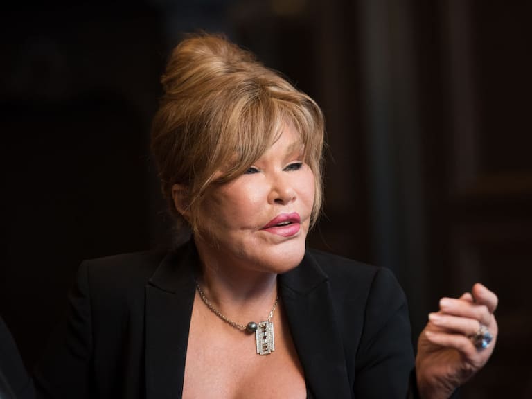Muere Jocelyn Wildenstein, popularmente conocida como ‘Catwoman’, a los 84 años