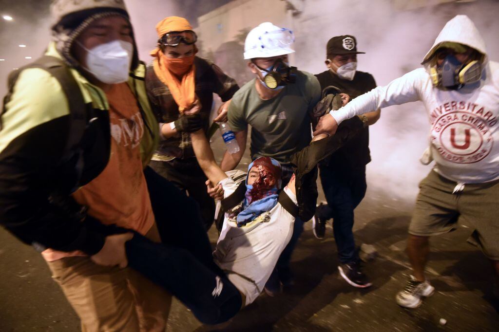 Voluntarios trasladan a una persona herida en medio de las manifestaciones en Lima