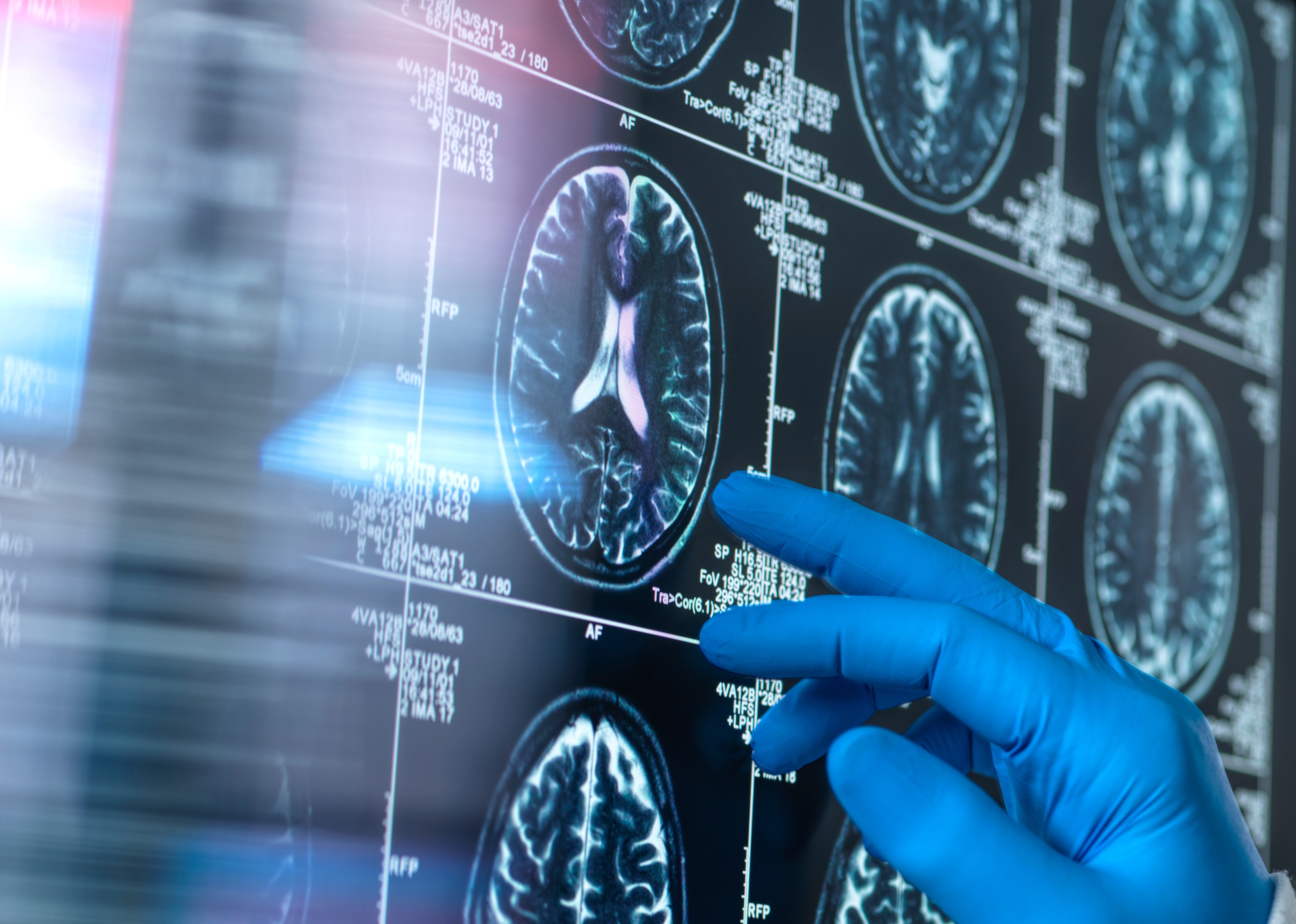 Cerebro