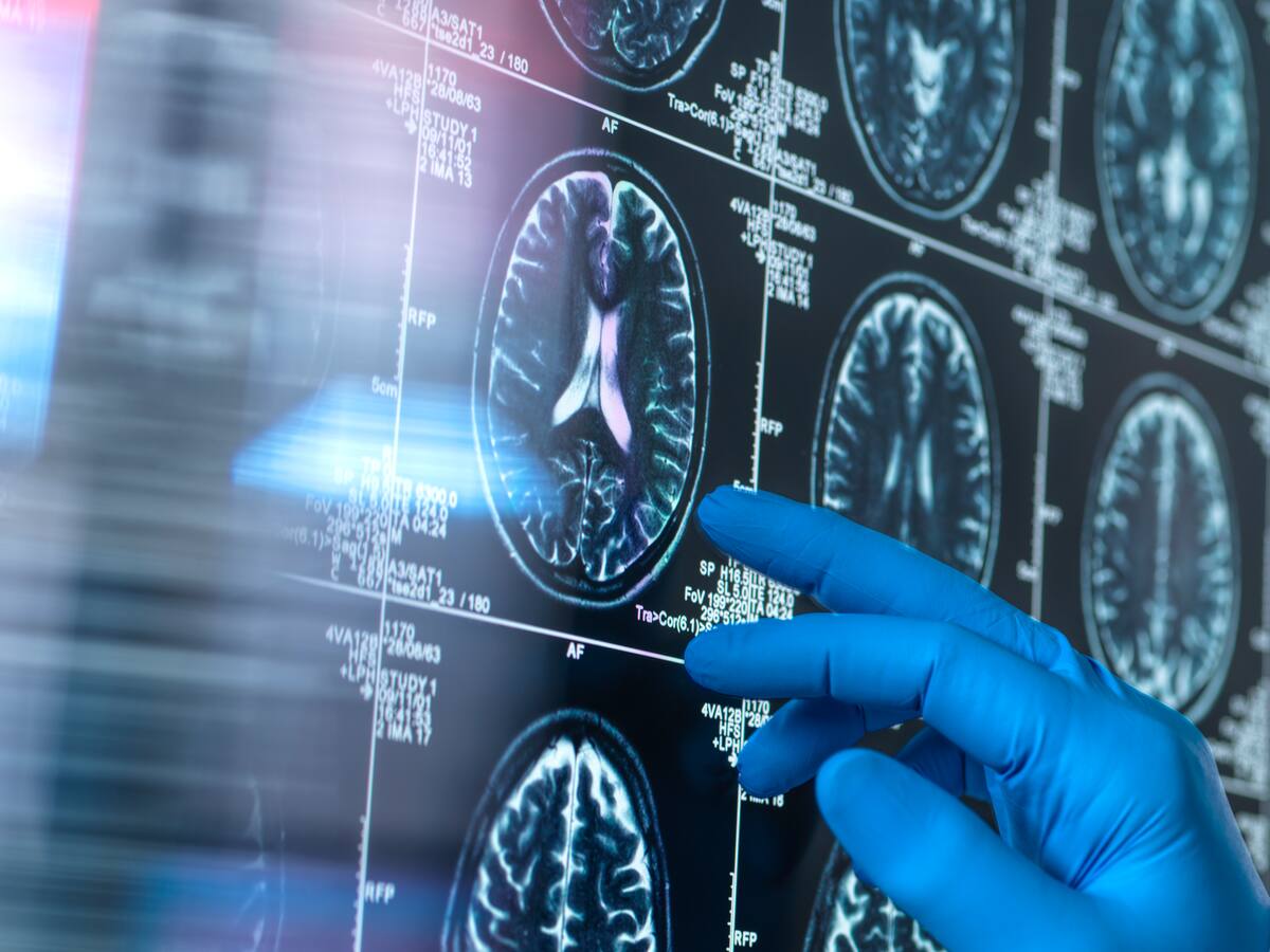 Este nutriente es esencial para nutrir el cerebro y se encuentra en estos alimentos