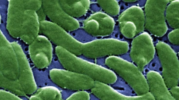 Bacteria “come carne” deja al menos siete muertos en EE.UU.: así puedes evitar contagios