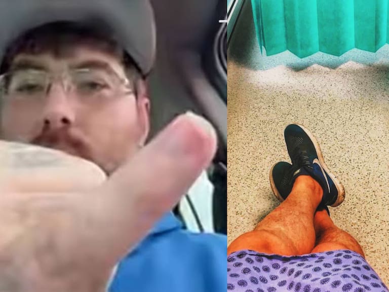 Hombre con el “pene más pequeño del mundo” se someterá a inédita operación: cambiará su vida