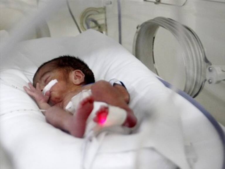 Bebé con dos cabezas alcanzó a vivir 32 horas en India antes de morir