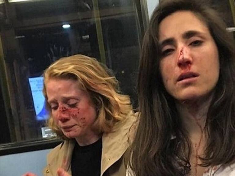 Policía inglesa detiene a cuatro adolescentes por agresión a pareja de mujeres en bus de Londres