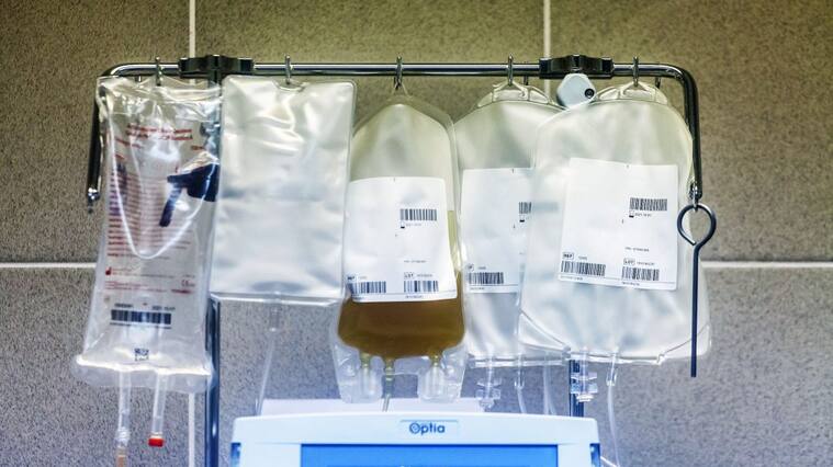 19 JUNIO 2020/OSORNO.- La máquina Spectra Optia con la bolsa de plasma de Alejandro, paciente recuperado de covid-19 positivo en el Banco de Sangre del Hospital Base San José de Osorno durante la emergencia sanitaria que ha provocado el coronavirus pandemia Covid-19.- FOTO: AGENCIAUNO.