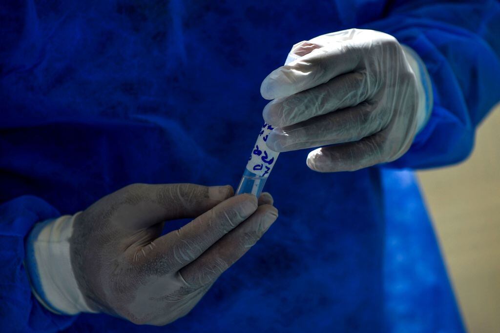 Un médico prepara el equipo para realizar un test del Covid-19