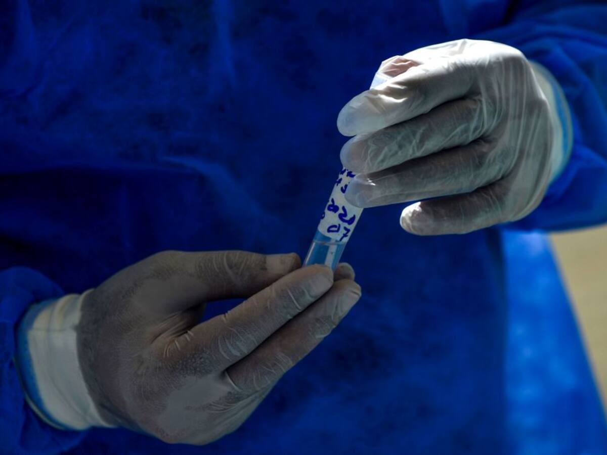Científicos de Argentina cerca de desarrollar los primeros test para el coronavirus
