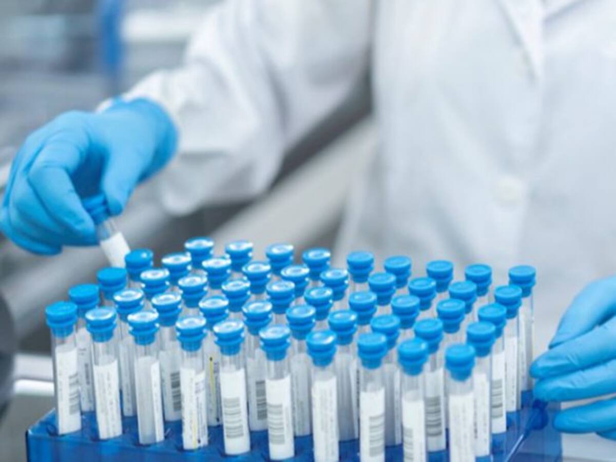 OMS reporta 780 casos de la viruela del mono en 27 países