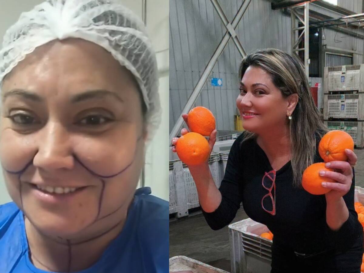 ¿Se encontrará con Daniella en “El Internado”? Denisse Campos revela por qué se sometió a cirugías estéticas