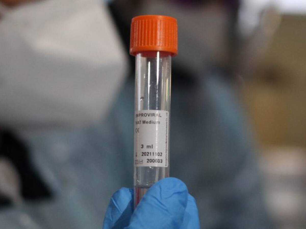 Ministerio de Salud reportó 99 muertos por Covid-19 durante las últimas 24 horas, llegando a un total de 19.897