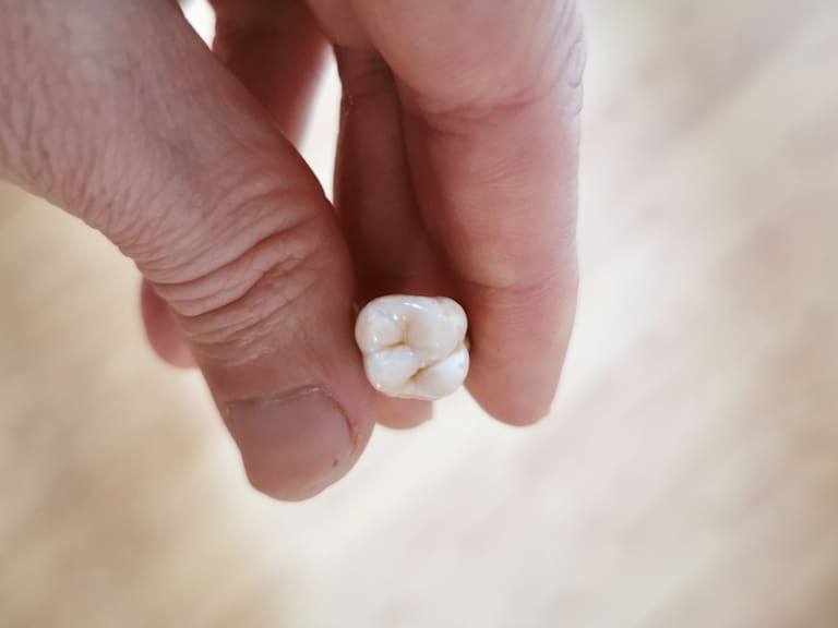 Qué significa soñar que se te caen los dientes, según una IA