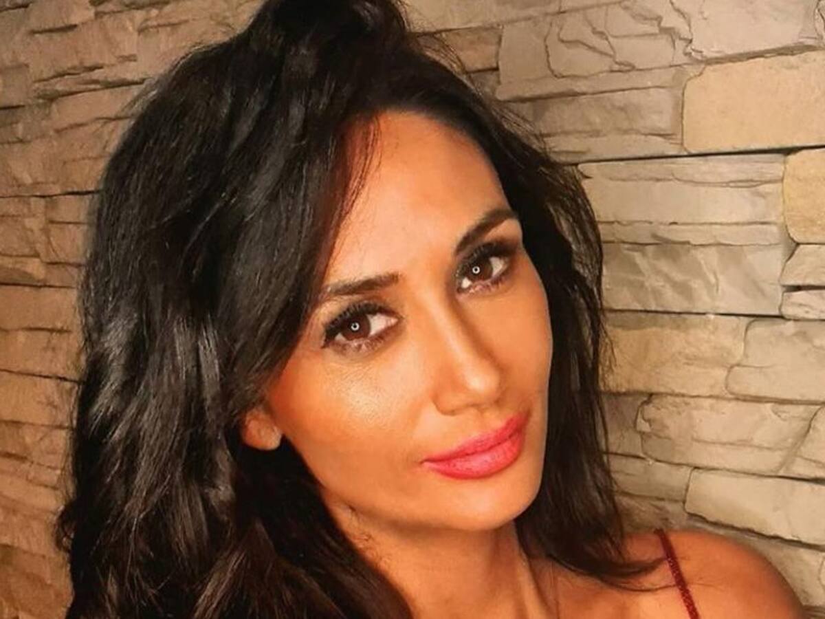 Así quedó el brazo de Pamela Díaz tras su segunda sesión para borrarse el tatuaje que se hizo con su ex, Rodrigo Wainraihgt