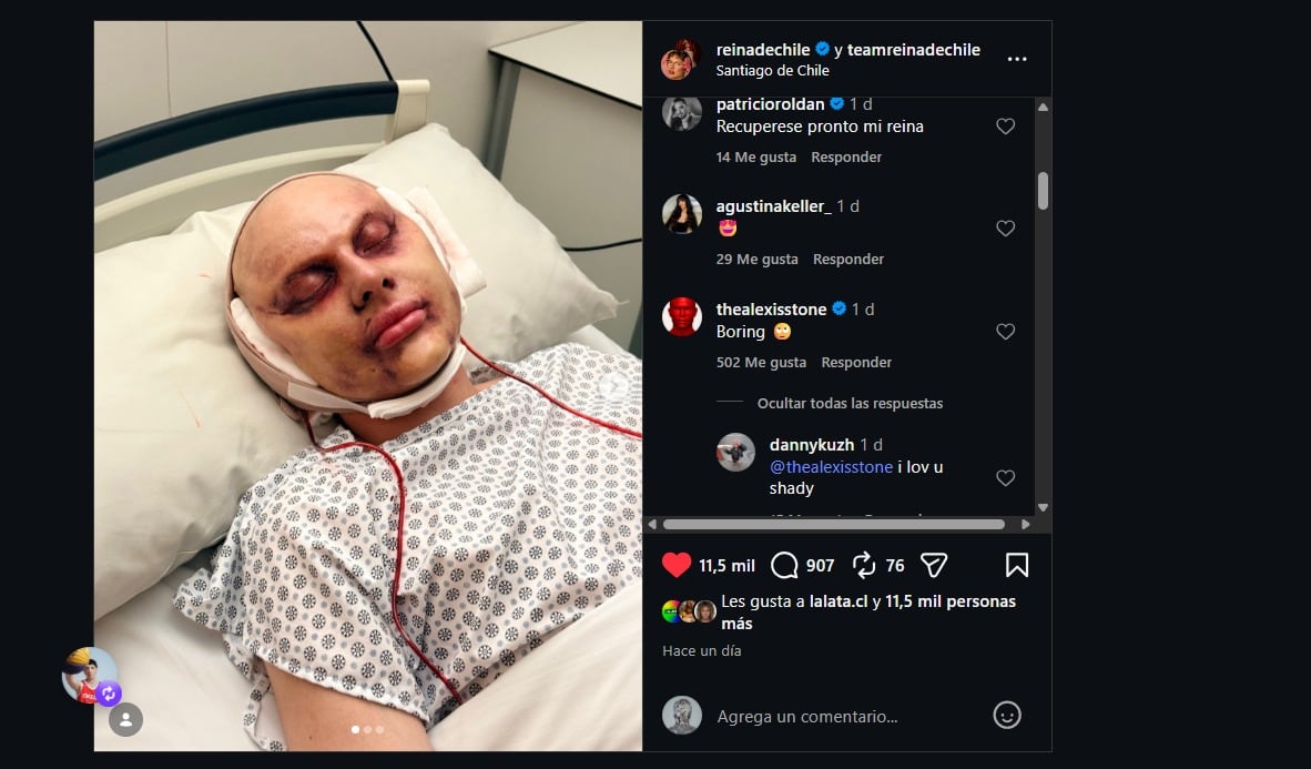 capturas