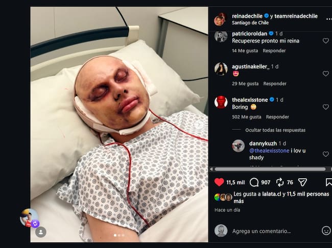 capturas