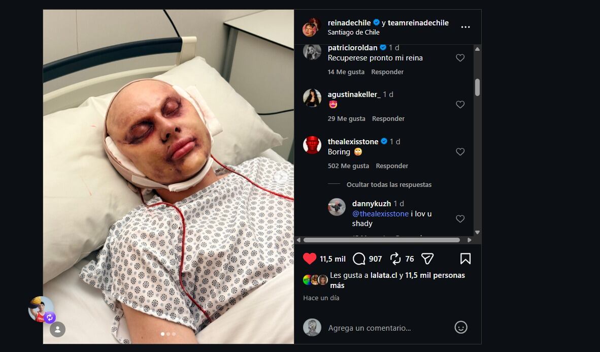 capturas