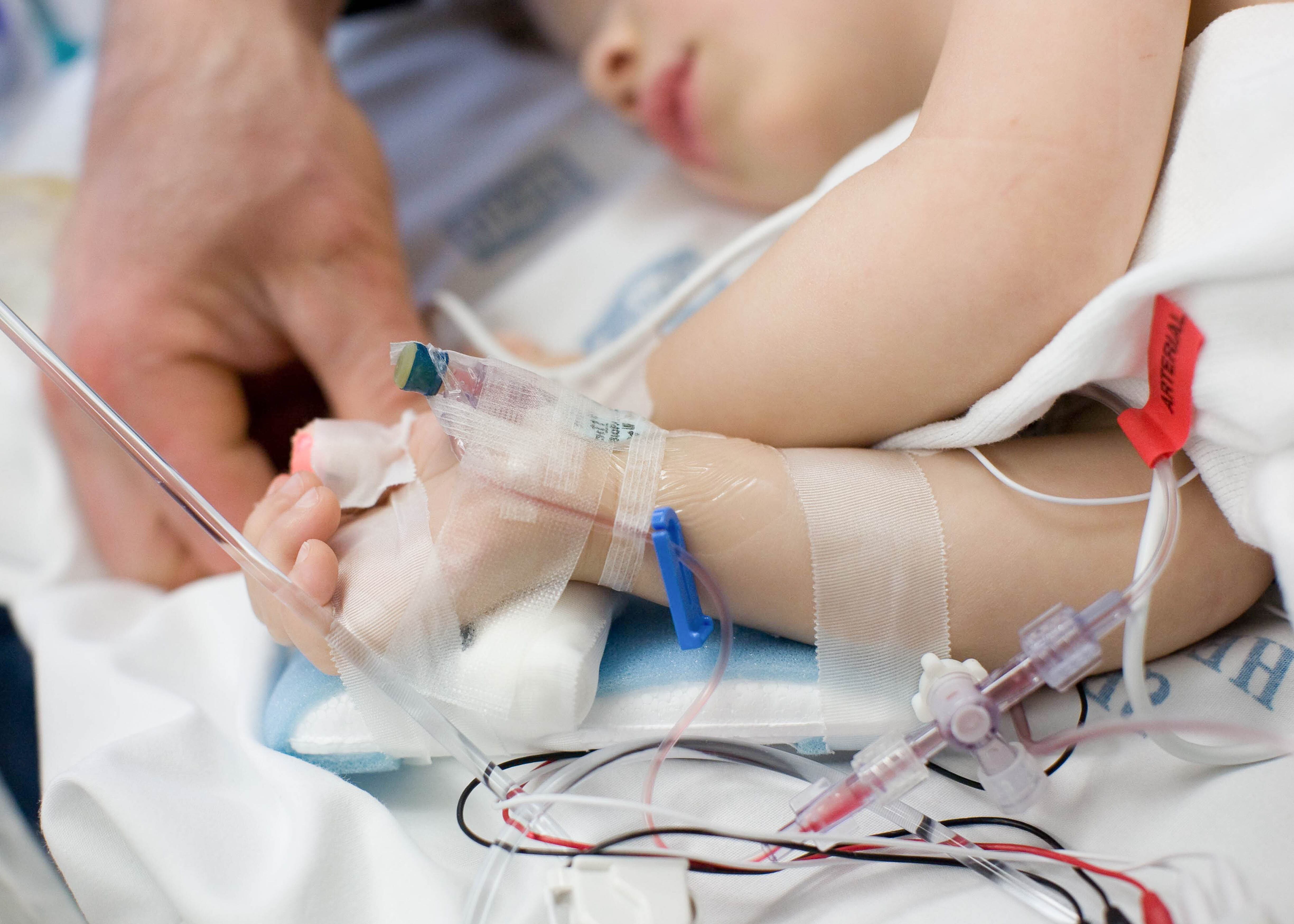 Trasplante fallido mantiene grave a niño de 2 años: recibió un corazón con daños