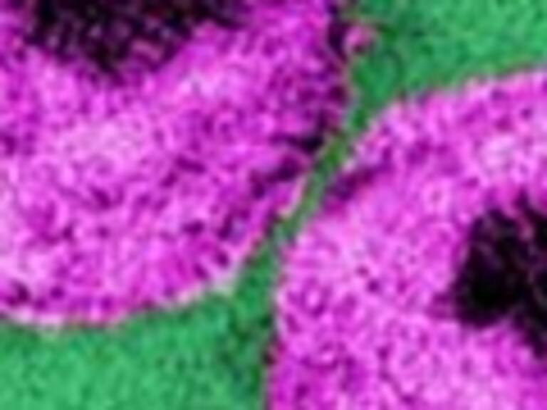 Investigadores catalanes descubrieron la molécula del VIH responsable de la propagación del Sida