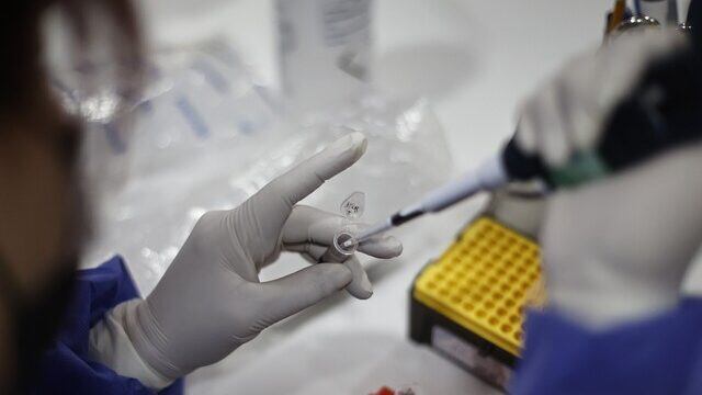 Epidemiólogo por viruela del mono: "La alerta de la OMS es razonable"