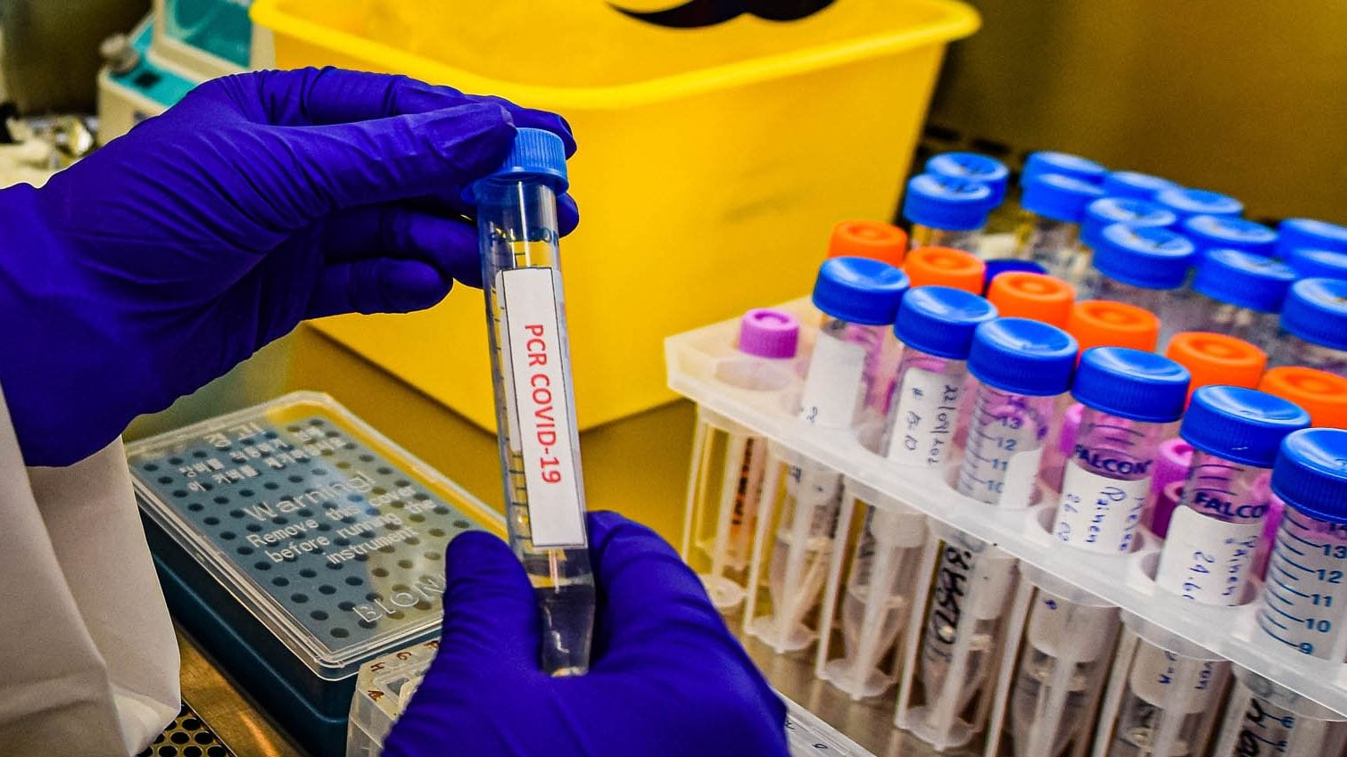 Coronavirus