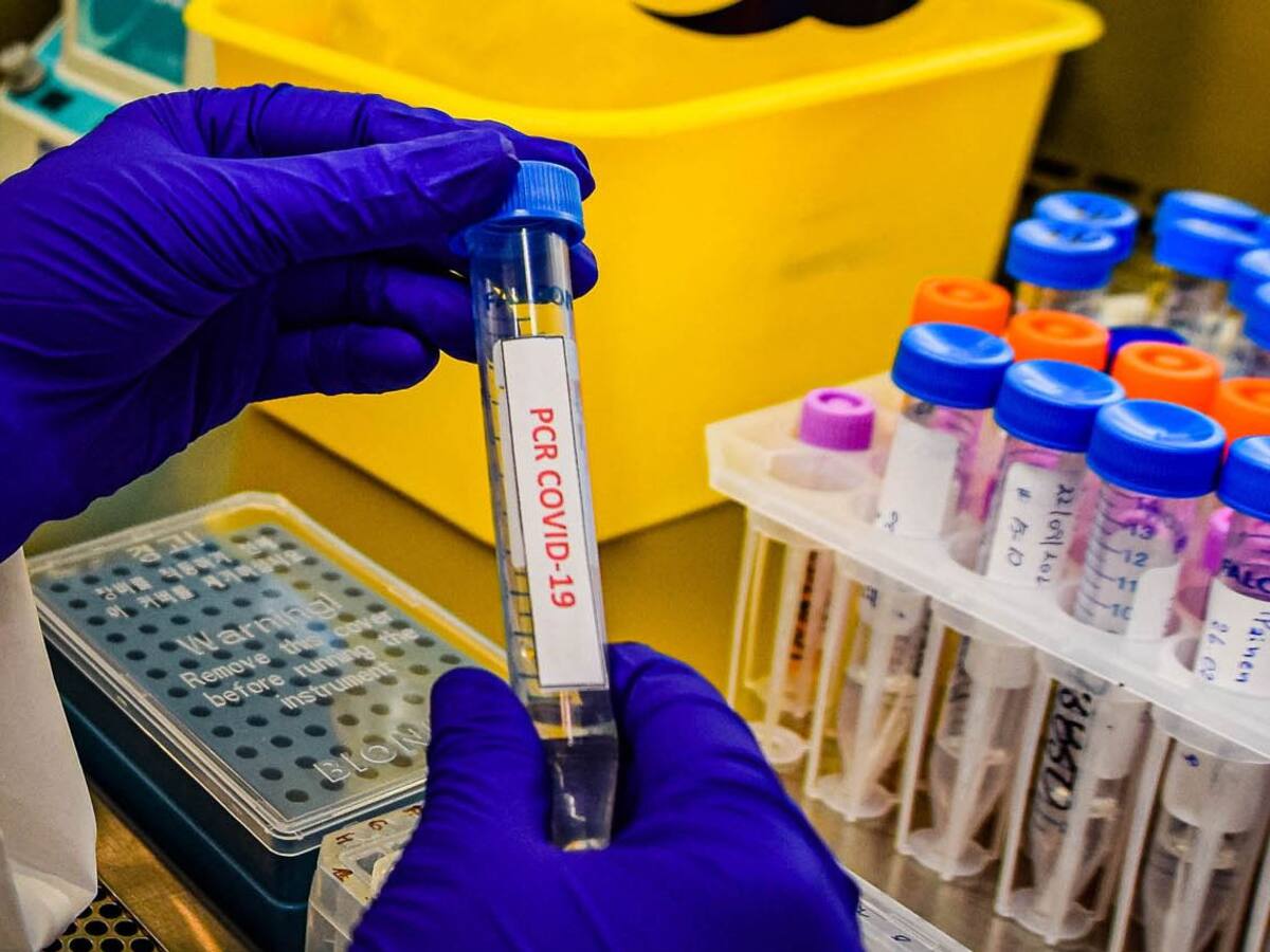 Argentina: Ministerio de Salud informó que más de 53 mil personas han muerto por coronavirus